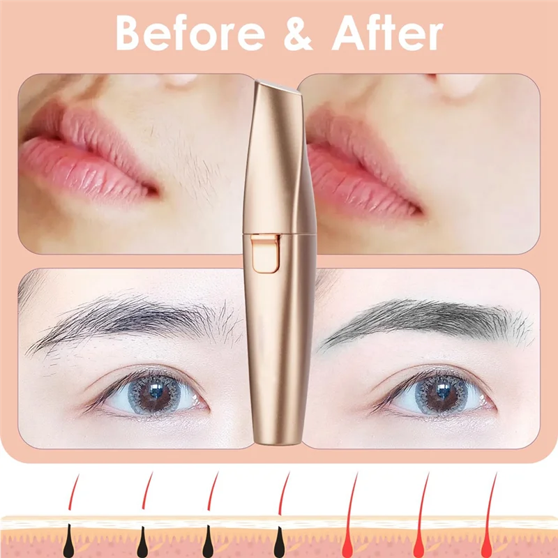 Lyzior™ Hair Removal Pen – Smooth Skin Instantly, Without Pain or Irritation-rosa-04